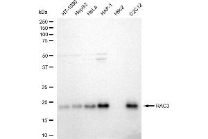 Western blotting analysis using RAC3 antibody (ABIN7800145).
