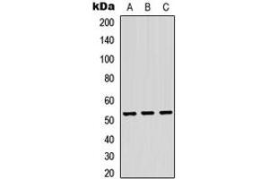 Western blot analysis of TRMT11 expression in HEK293T (A), Raw264.