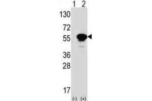 Western Blotting (WB) image for anti-Protein Kinase C and Casein Kinase Substrate in Neurons 1 (PACSIN1) antibody (ABIN3003674)