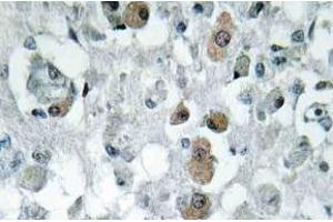 Immunohistochemistry (IHC) analyzes of GNPAT antibody in paraffin-embedded human brain tissue. (GNPAT antibody)