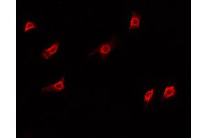 ABIN6266827 staining A549 cells by IF/ICC. (DKC1 antibody  (Internal Region))