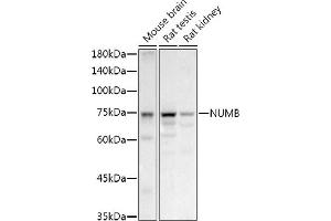 Western blot analysis of extracts of various cell lines, using NUMB antibody (ABIN6129424, ABIN6144943, ABIN6144944 and ABIN6224990) at 1:1000 dilution. (NUMB antibody  (AA 521-640))