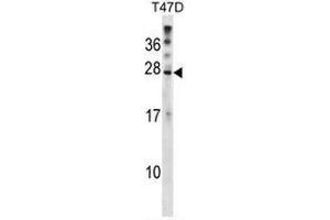 Western blot analysis in T47D cell line lysates (35µg/lane) using RNF4 Antibody (C-term) Cat.