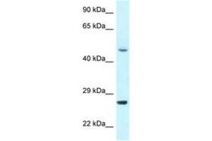 Image no. 1 for anti-Cyclin-Dependent Kinase 20 (CDK20) (N-Term) antibody (ABIN6747693)