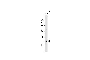 Anti-OBEC3C Antibody (C-Term) at 1:2000 dilution + PC-3 whole cell lysate Lysates/proteins at 20 μg per lane.