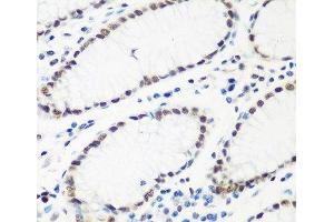 Immunohistochemistry of paraffin-embedded Human stomach using HTATSF1 Polyclonal Antibody at dilution of 1:100 (40x lens). (HTATSF1 antibody)