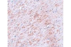 Immunohistochemical staining of rat brain tissue with DCLK2 polyclonal antibody  at 5 ug/mL dilution. (DCLK2 antibody  (C-Term))