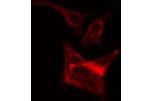 ABIN6266643 staining Hela cells by IF/ICC. (TGFA antibody)
