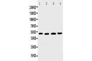 Anti-DR5 antibody, Western blotting Lane 1: HELA Cell Lysate Lane 2: MM231 Cell Lysate Lane 3: SGC Cell Lysate Lane 4:  Cell Lysate (TNFRSF10B antibody  (C-Term))