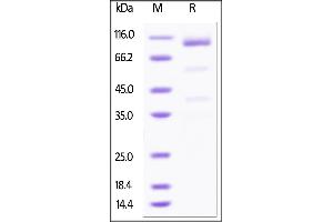 Human Glypican 3 / GPC3, Fc Tag, low endotoxin on SDS-PAGE under reducing (R) condition. (Glypican 3 Protein (GPC3) (AA 25-559) (Fc Tag))