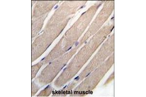 Forlin-fixed and paraffin-embedded hun skeletal muscle tissue reacted with P2K4 Antibody  (ABIN392418 and ABIN2842027) , which was peroxidase-conjugated to the secondary antibody, followed by DAB staining. (MAP2K4 antibody  (AA 235-264))