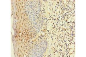 Immunohistochemistry of paraffin-embedded human tonsil tissue using ABIN7145011 at dilution of 1:100