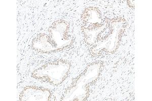 Immunohistochemistry (IHC) image for anti-Exportin 1 (XPO1) (C-Term) antibody (ABIN7453427)