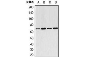 Western blot analysis of ARMCX2 expression in MCF7 (A), SP2/0 (B), PC12 (C), rat heart (D) whole cell lysates. (ARMCX2 antibody  (Center))