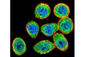 Confocal immunofluorescent analysis of IKK beta antibody with HeLa cells followed by Alexa Fluor 488-conjugated goat anti-rabbit lgG (green). (IKBKB antibody)