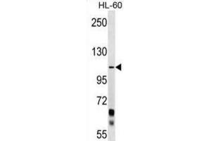 Western Blotting (WB) image for anti-Protocadherin alpha 10 (PCDHA10) antibody (ABIN2999486)
