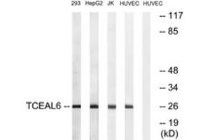 Western Blotting (WB) image for anti-Transcription Elongation Factor A (SII)-Like 6 (TCEAL6) (AA 61-110) antibody (ABIN2890666)
