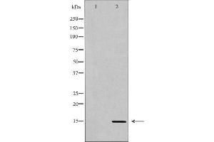 Western blot analysis of extracts of HeLa , using H3K36me3 Antibody The lane on the left is treated with the antigen-specific peptide. (Histone 3 antibody  (H3K36me3))