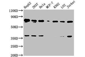 Western Blot Positive WB detected in: HepG2 whole cell lysate, 293T whole cell lysate, Hela whole cell lysate, MCF-7 whole cell lysate, K562 whole cell lysate, LO2 whole cell lysate, Jurkat whole cell lysate All lanes: UBC antibody at 1:2000 Secondary Goat polyclonal to rabbit IgG at 1/50000 dilution Predicted band size: 78 kDa Observed band size: 78 kDa (UBC antibody  (AA 19-36))