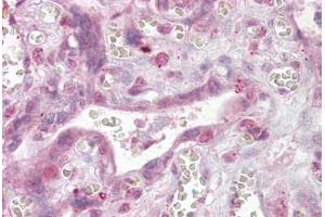 Anti-NFATC4 antibody IHC staining of human placenta.