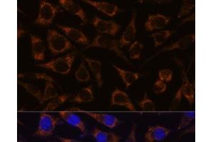 Immunofluorescence analysis of L929 cells using GTPBP8 Polyclonal Antibody at dilution of 1:100. (GTPBP8 antibody)