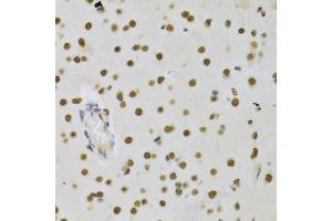 Immunohistochemistry of paraffin-embedded rat brain using DNMT3A Antibody (ABIN1872325) at dilution of 1:100 (40x lens). (DNMT3A antibody)