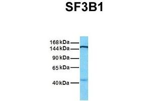 Western Blotting (WB) image for anti-Splicing Factor 3b, Subunit 1, 155kDa (SF3B1) (N-Term) antibody (ABIN2778700)