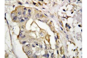 Immunohistochemistry (IHC) image for anti-CD40 Ligand (CD40LG) (AA 47-65), (N-Term) antibody (ABIN3044319)