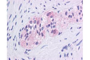 Immunohistochemistry with Colon, myenteric plexus tissue at an antibody concentration of 5. (EGR1 antibody  (N-Term))