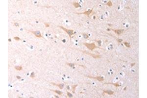 The image on the left is immunohistochemistry of paraffin-embedded Human brain tissue using ABIN7130977(SCGB1A1 Antibody) at dilution 1/60, on the right is treated with fusion protein. (SCGB1A1 antibody)