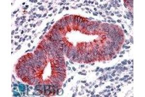 AP22445PU-N VPS29 antibody staining of paraffin embedded Human Uterus at 3. (VPS29 antibody  (Internal Region))
