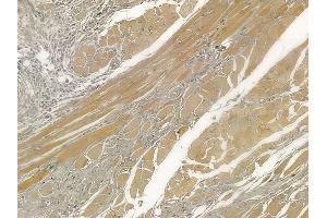 ABIN6257405 and ABIN6273977 at 1/100 staining human tongue carcinoma by IHC-P. (OR2H1 antibody  (C-Term))