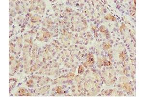 Immunohistochemistry of paraffin-embedded human pancreatic tissue using ABIN7175453 at dilution of 1:100 (BNIP1 antibody  (AA 1-200))