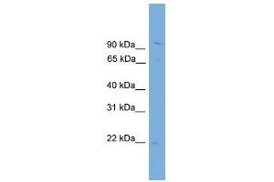 TPPP3 antibody used at 1 ug/ml to detect target protein. (TPPP3 antibody  (N-Term))