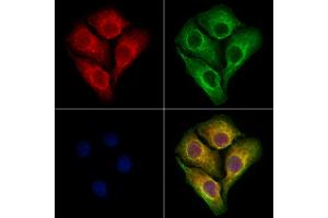 ABIN6264681 and ABIN6273070 staining Hela cells by IF/ICC.