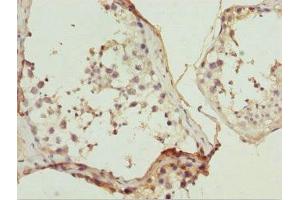 Immunohistochemistry of paraffin-embedded human testis tissue using ABIN7169215 at dilution of 1:100 (ULK4 antibody  (AA 1-290))
