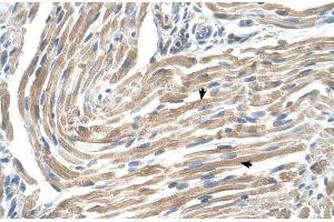 Human Muscle (MGST2 antibody  (N-Term))