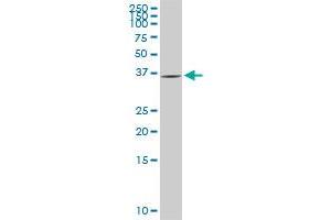 GYG1 monoclonal antibody (M08), clone 2C10. (Glycogenin 1 antibody  (AA 1-73))
