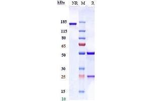 Anti-RHD / CD240d Reference Antibody (LFB Anti-RhD) on SDS-PAGE under reducing (R) condition.
