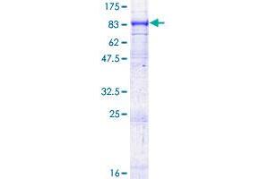 ABCG1 Protein (AA 1-678) (GST tag)