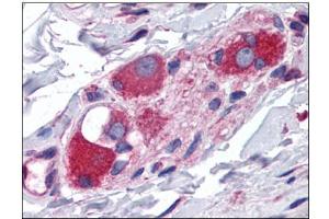 Human Small Intestine, Submucosal Plexus: Formalin-Fixed, Paraffin-Embedded (FFPE) (ARL6IP5 antibody  (C-Term))