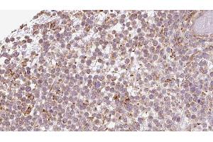 ATP8A1 antibody  (Internal Region)