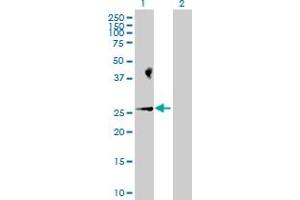 Western Blot analysis of BAD expression in transfected 293T cell line by BAD MaxPab polyclonal antibody.