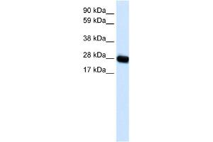 WB Suggested Anti-CAV3 Antibody Titration:  0. (Caveolin 3 antibody  (N-Term))