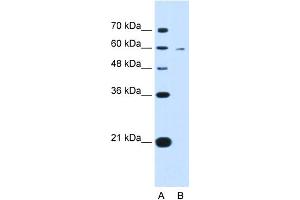 WB Suggested Anti-KYNU Antibody Titration:  0. (KYNU antibody  (C-Term))