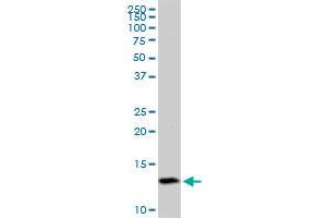 TIMM8A MaxPab polyclonal antibody. (TIMM8A/DDP antibody  (AA 1-97))