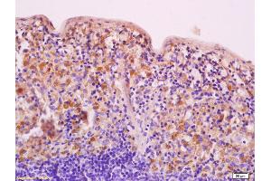 Formalin-fixed and paraffin embedded human brain labeled with Anti-HDAC5 Polyclonal Antibody, Unconjugated (ABIN681043) at 1:200 followed by conjugation to the secondary antibody and DAB staining (HDAC5 antibody)