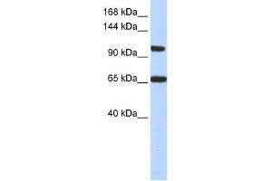 WB Suggested Anti-THRAP3 Antibody Titration:  0. (THRAP3 antibody  (Middle Region))