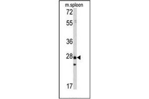 Image no. 1 for anti-Protein Tyrosine Phosphatase Type IVA, Member 1 (PTP4A1) antibody (ABIN360770) (PTP4A1 antibody)