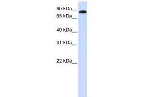 ADAM19 antibody used at 1 ug/ml to detect target protein. (ADAM19 antibody)